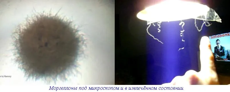 Метастазы Мексиканского залива. Часть 9-2