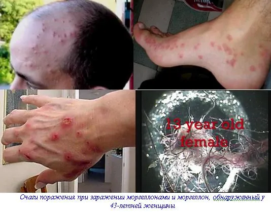 Метастазы Мексиканского залива. Часть 9-2