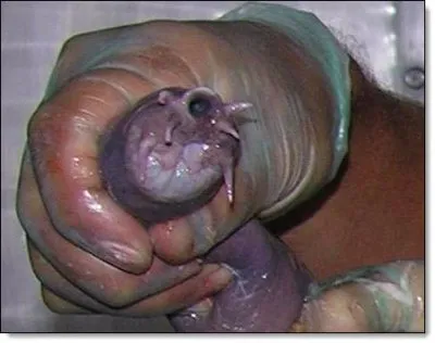 О четырех принципах системного паразитизма на примере FAQ Андерсена