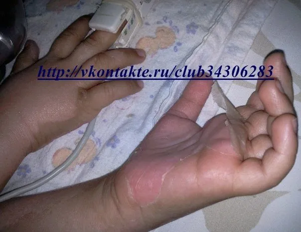 СРОЧНО НЕОБХОДИМА ПОМОЩЬ МАЛЕНЬКОМУ ЕГОРКЕ (4года)