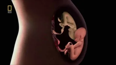 Жизнь до рождения. Близнецы / In The Womb. Twins, Triplets And Quads (2009) HDTVRip