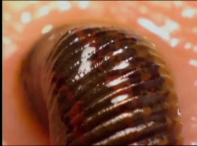 Discovery: Лечим укусами: пиявки, личинки и пчелы / Discovery: Leeches, Maggots And Bees: The Bite That Cures (2000) DVDRip