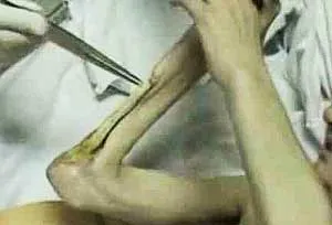 Наркотическая война против русов разворачивается с новой силой