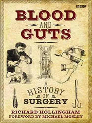 BBC: История хирургии. Кровоточащие сердца / Blood and Guts. A History of Surgery. Bleeding Hearts (2009) SATRip