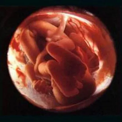 На Урале найдены бочки с человеческими эмбрионами