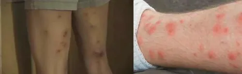 Метастазы Мексиканского залива - часть 14-1