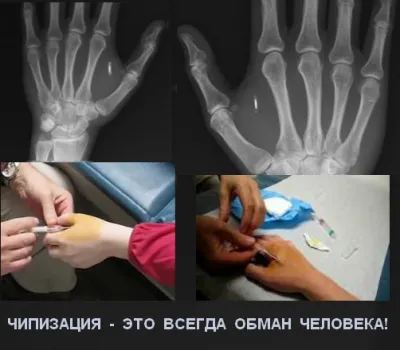 С 01.09 в Москве преступно вводится "чипизация" детей-школьников