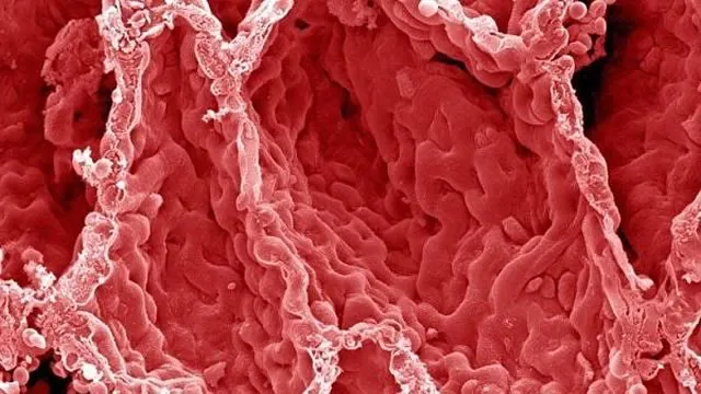 Рак как форма существования клетки.