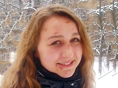 Антифашисты в Киеве избили девушку