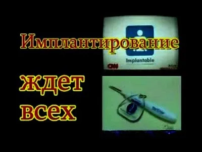Чипы. Имплантирование. Электронный концлагерь