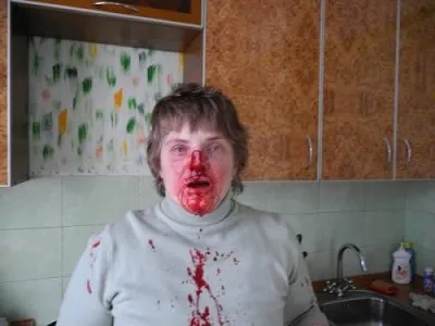 Женщина вступилась за котёнка, которого избивали дети кавказца и была жестоко избита.