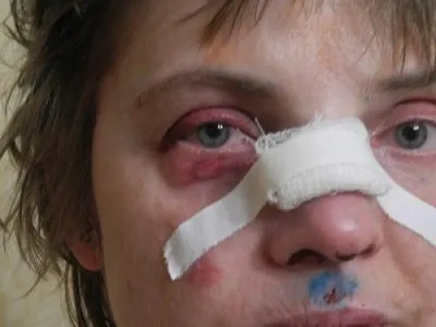 Женщина вступилась за котёнка, которого избивали дети кавказца и была жестоко избита.