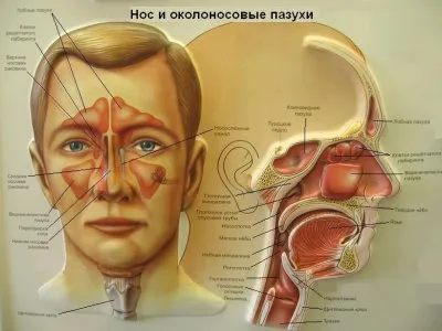 Как вылечить насморк