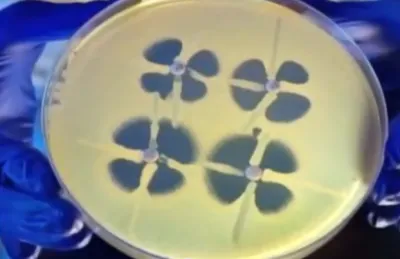 В США появилась особо опасная смертоносная бактерия — медицина бессильна…