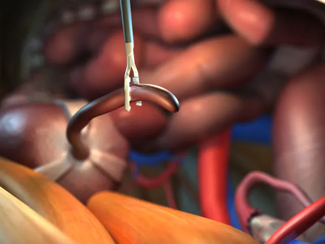 А нужен ли аппендикс?