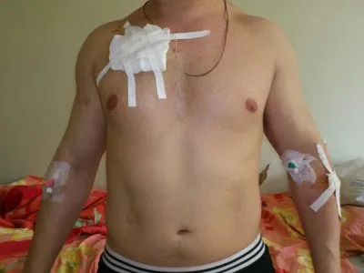 В Твери кавказцы при поддержке власти продолжают нападения на участников Народного Схода