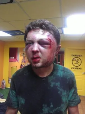 Награда нашла героя. Главного идеолога голых феменисток избили в Киеве