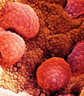 Война за возможность эволюции. Битва неоднородности с однородностью