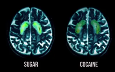 ЗАВИСИМОСТЬ ОТ САХАРА СИЛЬНЕЕ, ЧЕМ ОТ КОКАИНА