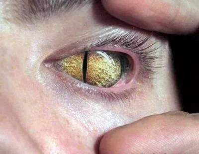 Юг против Севера