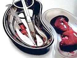 Смысл войны на Украине: органы гоев для раввинов-«трансплантологов»