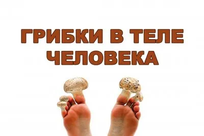 Грибки в теле человека. Ольга Бутакова (видео)