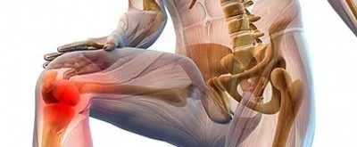 ПОЧЕМУ ХРУСТЯТ СУСТАВЫ: ИССЛЕДОВАНИЯ, СТАТЬИ, ОБЗОР МИФОВ