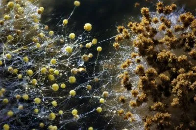 Как избавиться от грибов и плесени в организме человека