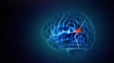 Мозг изменяющий себя сам (Нейропластичность Мозга). Документальный фильм