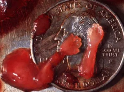 В США разрешили делать аборты на любом сроке беременности