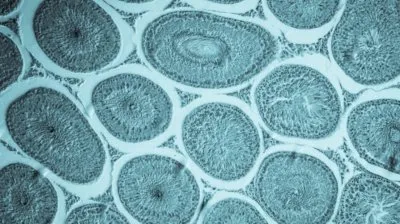 Чем заблокировать рост метастаз при онкологии