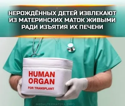 У живых абортированных детей на поздних сроках изымали печень