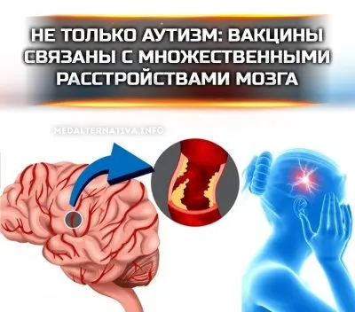Вакцины могут вызывать многие расстройства головного мозга