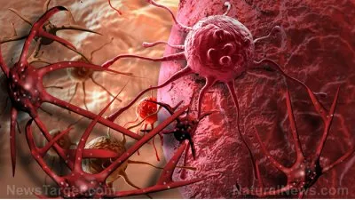 Вакцинация: уничтожение иммунитета и рак